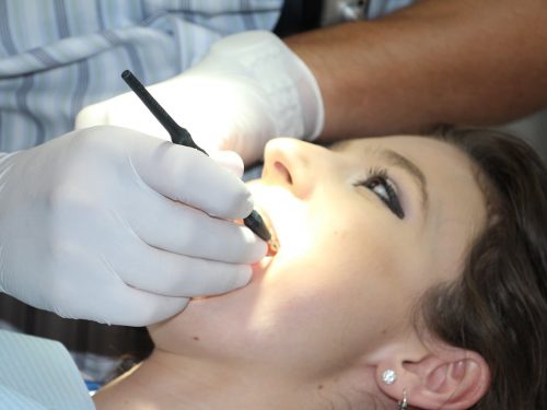 Leczenie kanałowe – kiedy twoje zęby go potrzebują