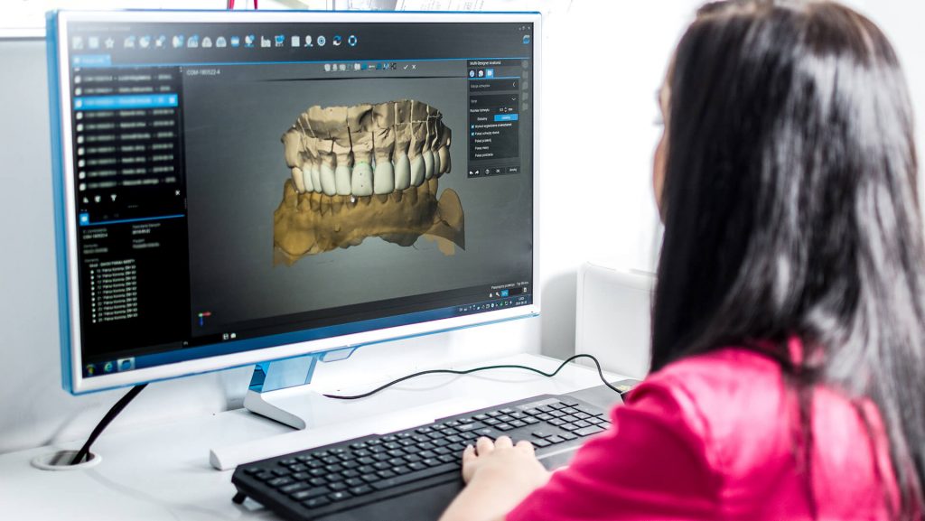 Cyfrowy wycisk czy masa? Mieszalnik Heraeus Kulzer Dynamix