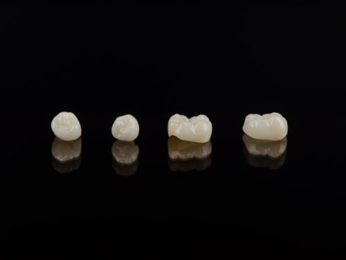 Metody odbudowy zęba — jakie są i od czego zależy ich wybór