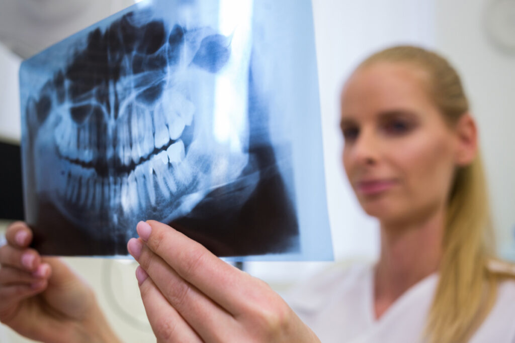 Dentystka analizuje zdjęcie rtg zębów. Zęby mądrości – co warto wiedzieć o ósemkach