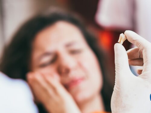 Rana po wyrwaniu zęba – zasady szybkiego gojenia