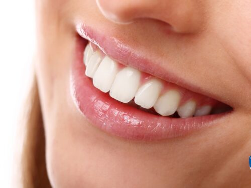 Wybielanie lampą Polilux – czy to bezpieczne?